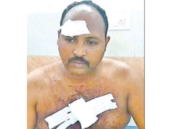 కత్తితో దాడి గాయాలు, కారం చల్లిన భార్య