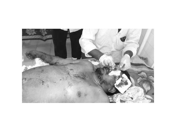 women attacked by lover women attacked by lover