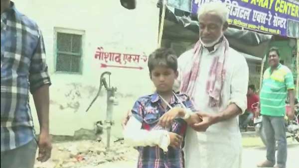 Negligence : Plaster Right Hand of Child Who Suffered Fracture On Left Hand Negligence : Plaster Right Hand of Child Who Suffered Fracture On Left Hand