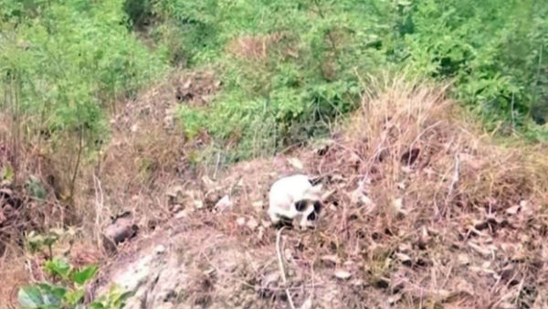 Skeletons found outside Bihar hospital where 108 children died of encephalitis Skeletons found outside Bihar hospital where 108 children died of encephalitis