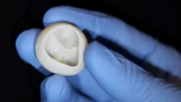 US scientists built functional heart parts out of collagen,calls it a major breakthrough US scientists built functional heart parts out of collagen,calls it a major breakthrough