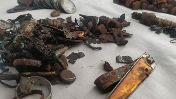 452 metal items found in ahmedabad man stomach 452 metal items found in ahmedabad man stomach