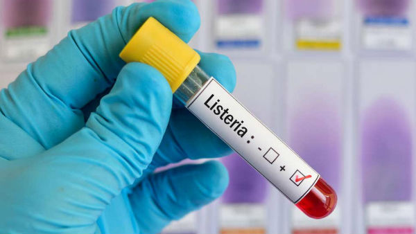 Spain issues international health alert over listeriosis outbreak Spain issues international health alert over listeriosis outbreak