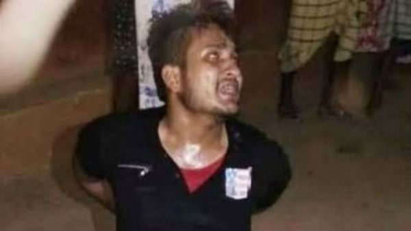 పుర్రె ప్రాక్చర్ ..