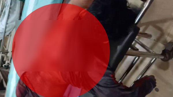 Karnataka police firing in Mangaluru 3 protesters critical in ICU Karnataka police firing in Mangaluru 3 protesters critical in ICU
