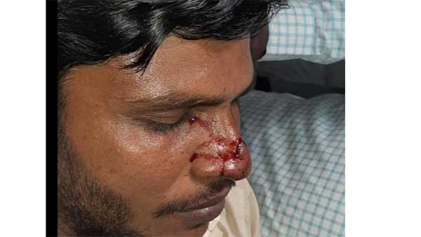 టీఆర్ఎస్,బీజేపీ ఘర్షణలు