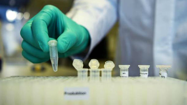 Coronavirus test should be capped at Rs 4500:Government to Private labs Coronavirus test should be capped at Rs 4500:Government to Private labs