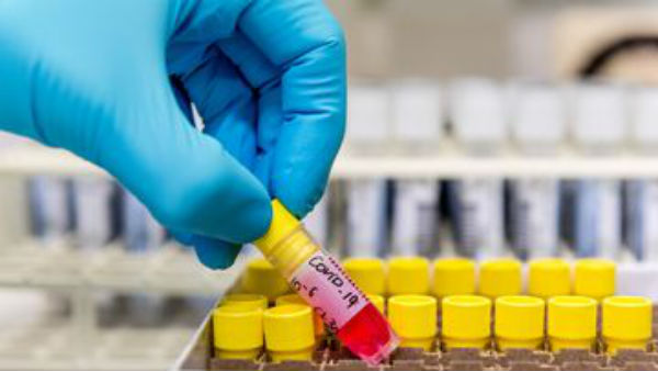 Anti Covid-19 drug remdesivir Flops in First Human Trial: Reports Anti Covid-19 drug remdesivir Flops in First Human Trial: Reports