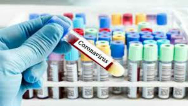చైనా కరోనా చావులు గుర్తుకు రాలేదా ?