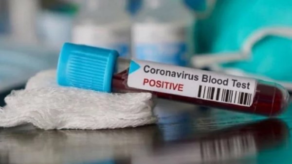 telugu tv serial actor tested coronavirus positive telugu tv serial actor tested coronavirus positive