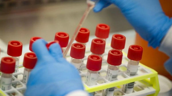 First case of covid-19 was reported from Chinas WHO office: WHO First case of covid-19 was reported from Chinas WHO office: WHO