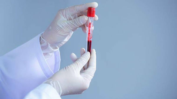 ap govt warns private labs to cancel licences on faulty covid 19 results ap govt warns private labs to cancel licences on faulty covid 19 results