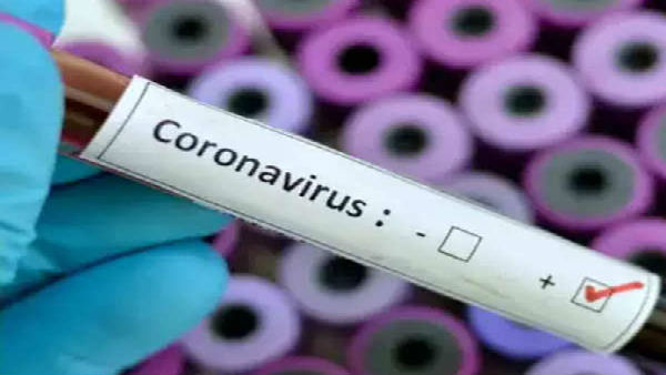Corona Positive to Gunmen, Photographer .. Rajahmundry MP Margani Bharath in Quarantine Corona Positive to Gunmen, Photographer .. Rajahmundry MP Margani Bharath in Quarantine