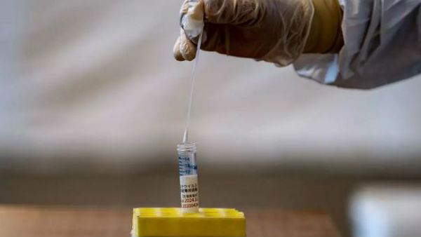 USFDA approved Corona-reducing ointment USFDA approved Corona-reducing ointment
