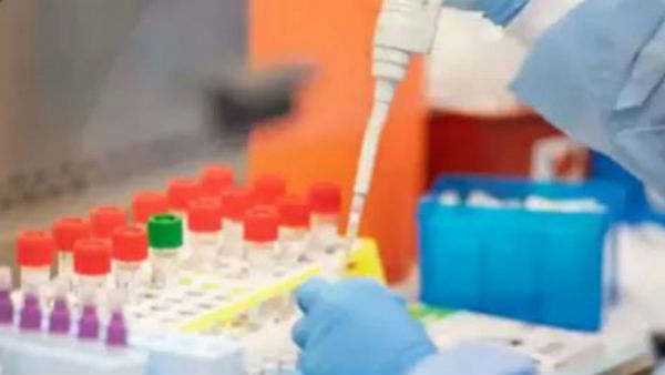 Remdesivir: US Approves First Antiviral Drug to Treat Covid-19, Cuts Recovery Period by 5 Days Remdesivir: US Approves First Antiviral Drug to Treat Covid-19, Cuts Recovery Period by 5 Days