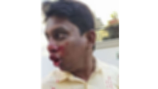 బీజేపీ నేతలపై ఎంఐఎం నాయకుల దాడి..