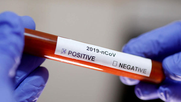 Telangana: 609 Covid19 positive cases and and 3 deaths reported in last 24 hours Telangana: 609 Covid19 positive cases and and 3 deaths reported in last 24 hours