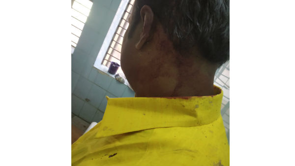 మదనపల్లి వద్ద ఘటన..
