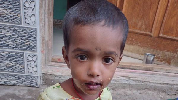 Help to save 1 year old Thanushree from serious Heart problem Help to save 1 year old Thanushree from serious Heart problem
