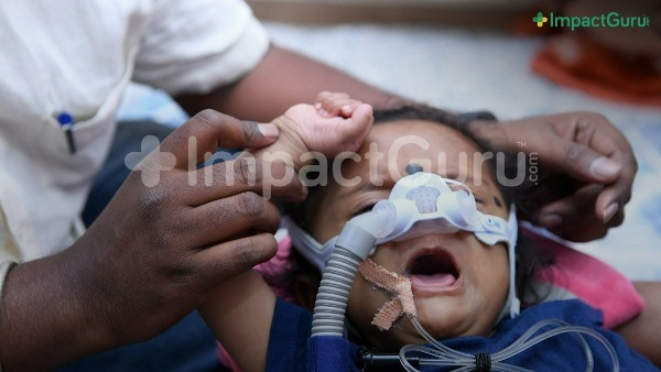Baby Janish Needs A Wonder Drug To Survive SMA, Please Help Baby Janish Needs A Wonder Drug To Survive SMA, Please Help