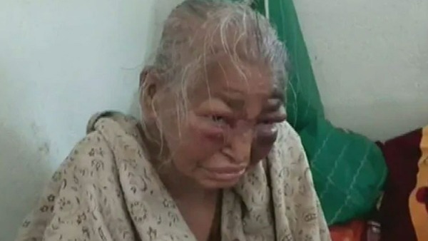 BJP workers mother Shova Majumdar who was allegedly beaten by TMC dies BJP workers mother Shova Majumdar who was allegedly beaten by TMC dies
