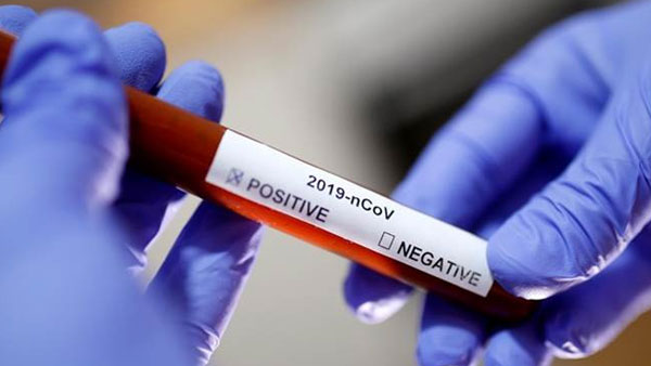 covid 19 positive again after vaccination ? ap government says no worry covid 19 positive again after vaccination ? ap government says no worry