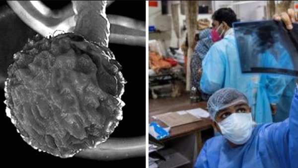 ఫ్యామిలీకి సోకుతుందని అనుమానంతో !
