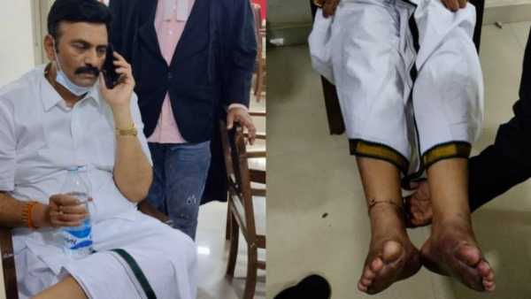తానే గాయం చేసుకున్నారన్న సీఐడీ