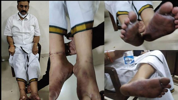 టీడీపీలో ఉలికిపాటు..