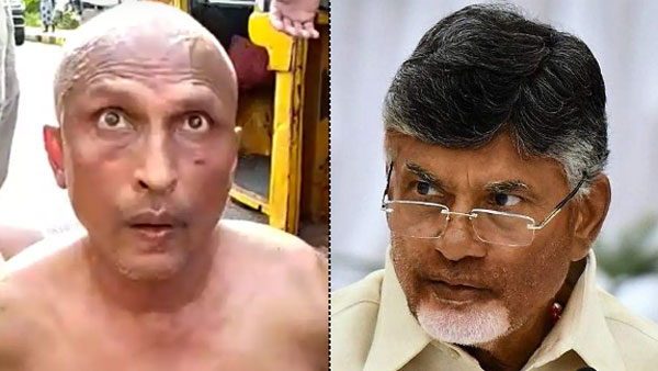 డాక్టర్ సుధాకర్.. ఎంపీ రఘురామ