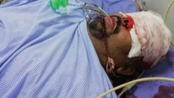 Raod Accident in Nellore, Film critic Kathi Mahesh suffers serious injuries Raod Accident in Nellore, Film critic Kathi Mahesh suffers serious injuries