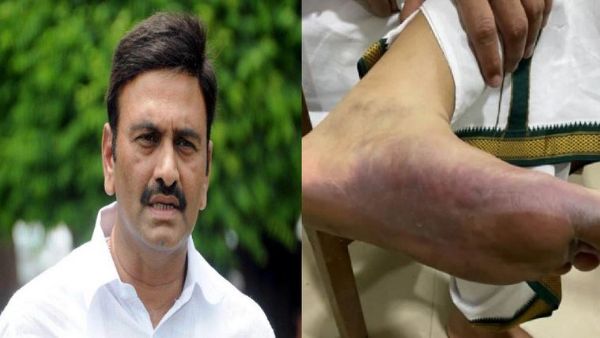 Raghu Rama krishnaraju arrest issue: Lok Sabha speaker office order Union home secretary Raghu Rama krishnaraju arrest issue: Lok Sabha speaker office order Union home secretary