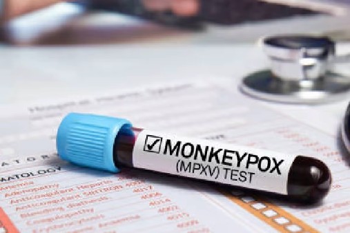 2 Monkeypox Cases, Centre Asks For Strict Screening Of Passengers 2 Monkeypox Cases, Centre Asks For Strict Screening Of Passengers