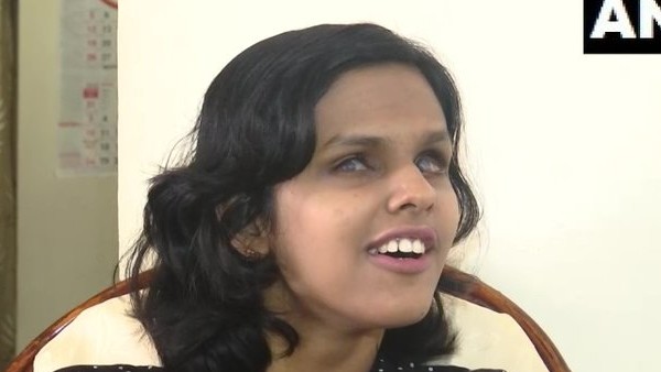 మైక్రోఫ్తాల్మియా..