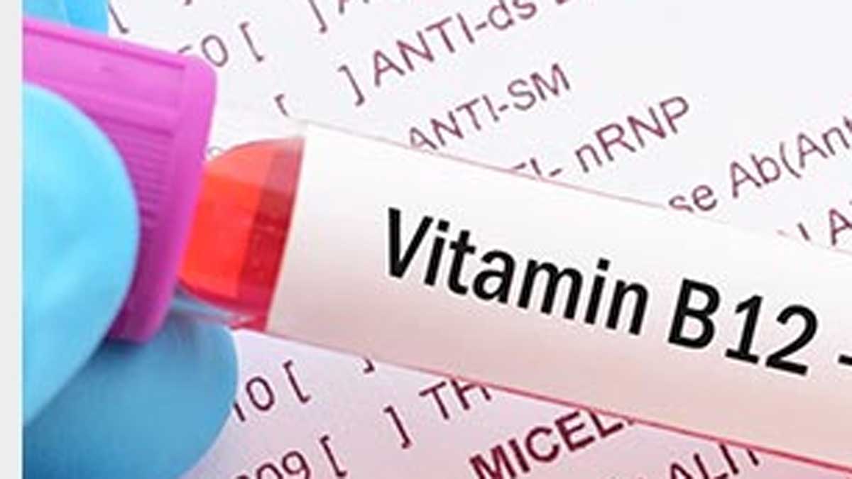 health tips విటమిన్ బి12 లోపమా? ఈ లక్షణాలుంటే ఈ ఆహారం తీసుకోండి