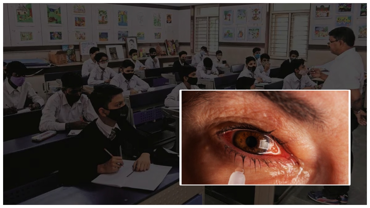 పేరెంట్స్ కు అలర్ట్, పిల్లల్లో కళ్లకలక - స్కూళ్లల్లో వ్యాప్తి, సూచనలు ఇవే..!!