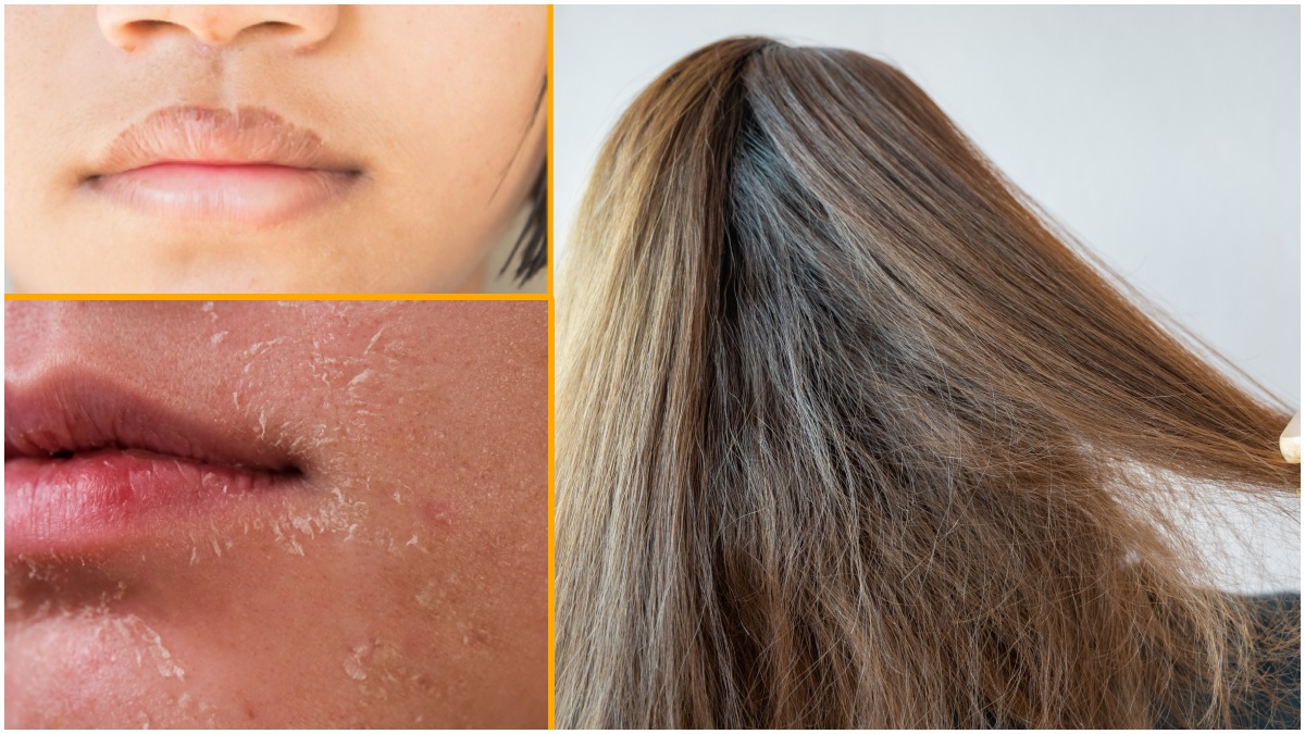 పొడి చర్మం, పొడిబారిన జుట్టు, పెదవుల పగుళ్ళ నివారణకు నాభిలో నాలుగు